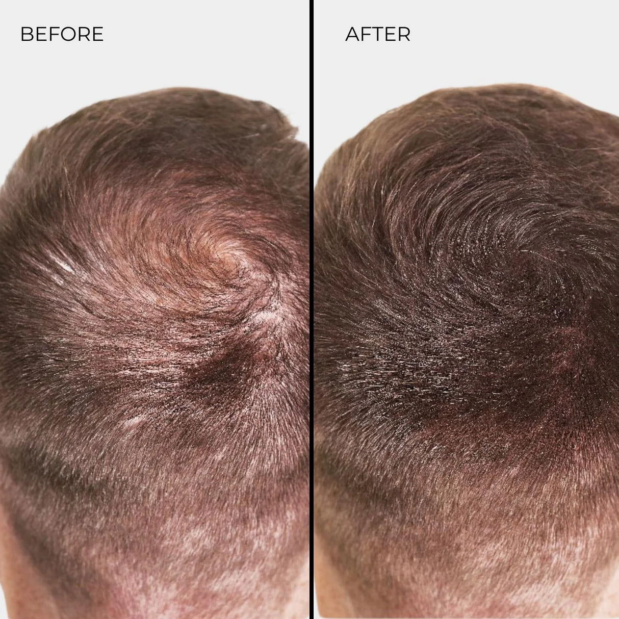 Fibra Espessante para Cabelo Nanogen Castanho Claro 15g