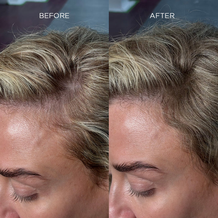 Fibra Espessante para Cabelo Nanogen Branca