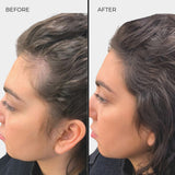 Nanogen Hair Thickening Fibre Medium Brown - BVShop