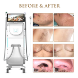 Skin Monarch Quantum Pro Diode & Picosecond Laser - BVShop